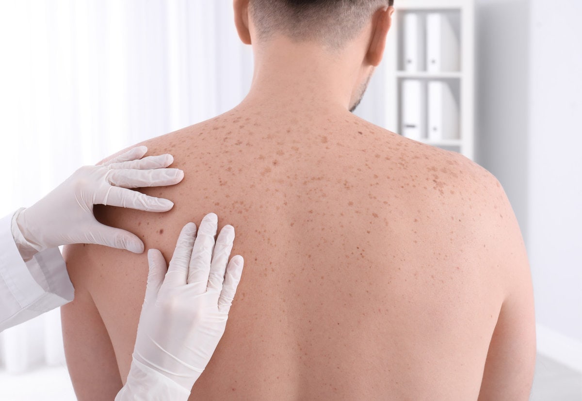 SKIN CANCER & MOHS SURGERY