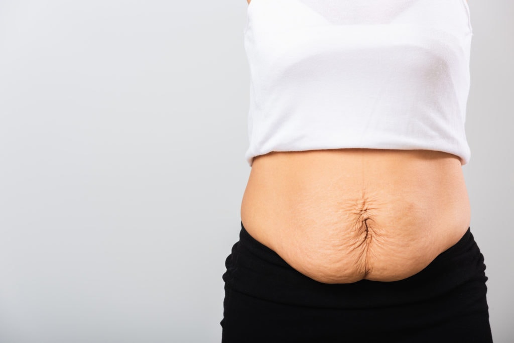 COOLSCULPT® YOUR WAY TO LOWER BODY FAT AND A BETTER LOOKING BODY
