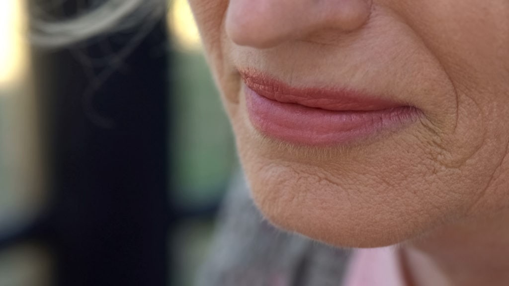 SKIN HEALTH WITH DR. GERMAIN ~ OPTIONS TO REVERSE SIGNS OF AGING